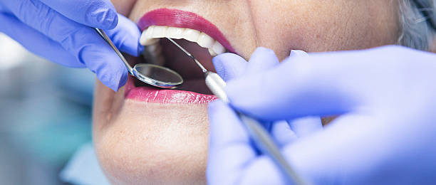 Best Teeth Whitening  in Homerville, GA